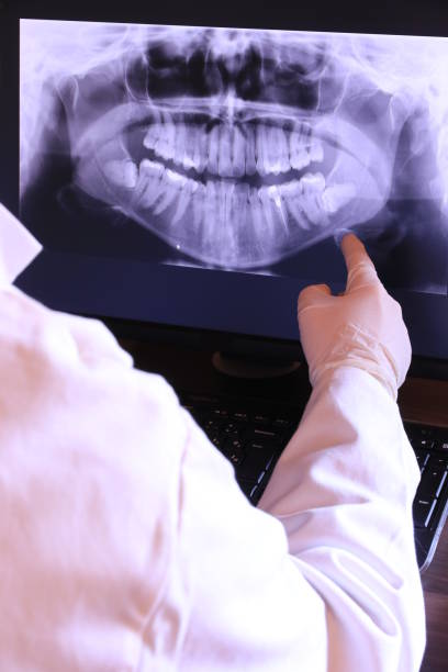 Best Emergency Denture Repair in Lake Lorraine, FL