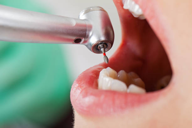 Best Walk-In Emergency Dental Services in Lake Lorraine, FL
